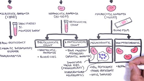 Anaemia (anemia) - classification (microcytic, normocytic and macrocytic) and pathophysiology ...