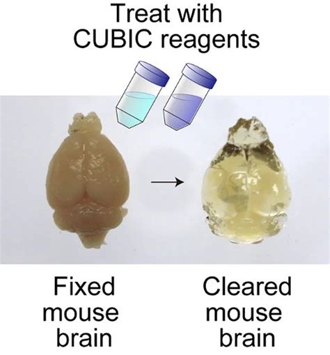 fixed clear mouse brain imaging riken – Neuroscience News