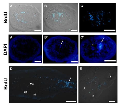 BrdU detection in sections of segmented worms after a 24 hour pulse. A ...