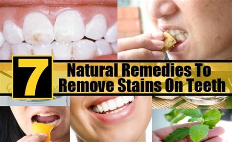 7 Natural Remedies To Remove Stains On Teeth | Stain remover, Natural ...