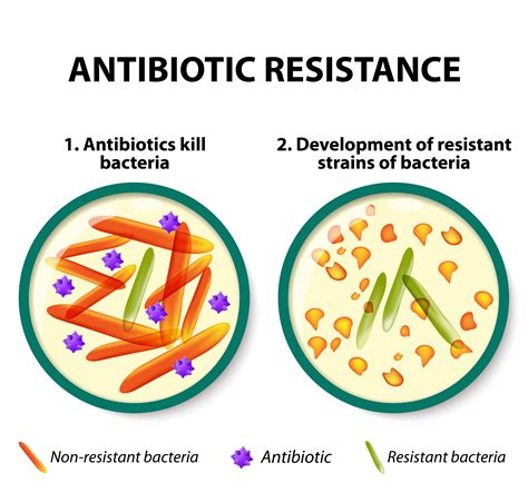 Antibiotic Resistance in Canada | The Canadian Encyclopedia