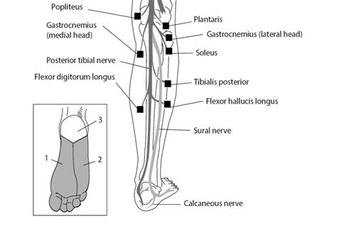 Posterior Tibial Nerve Entrapment