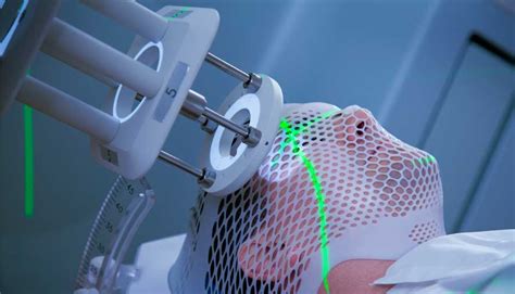 Top 10 Companies In The Radiotherapy - Verified Market Reports