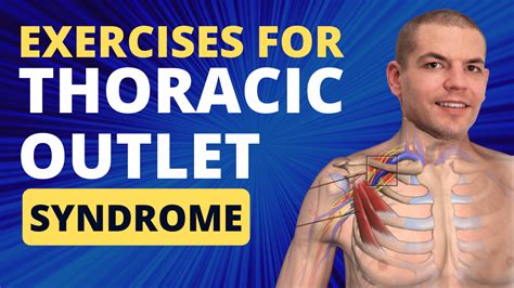 Exercises for Thoracic Outlet Syndrome | Treatment For TOS