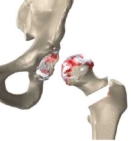 The Most Common Types of Orthopedic Conditions The Most Common Types of ...