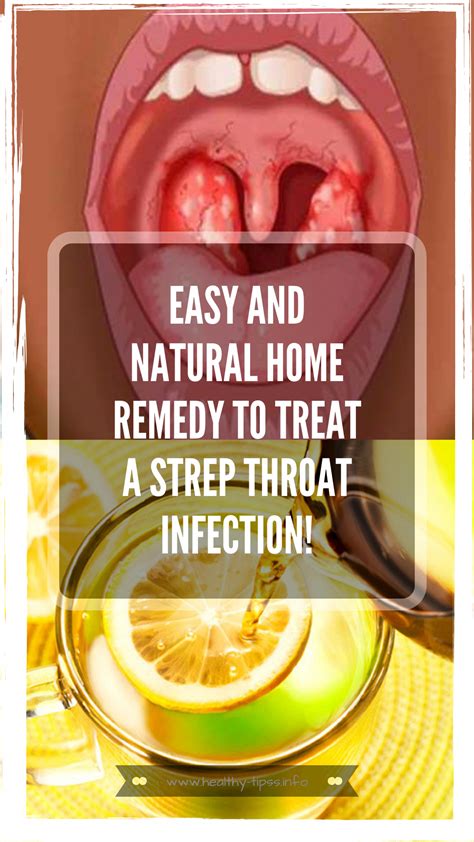 EASY AND NATURAL HOME REMEDY TO TREAT A STREP THROAT INFECTION! in 2020 ...