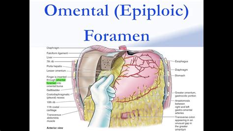 Omental Foramen Cadaver