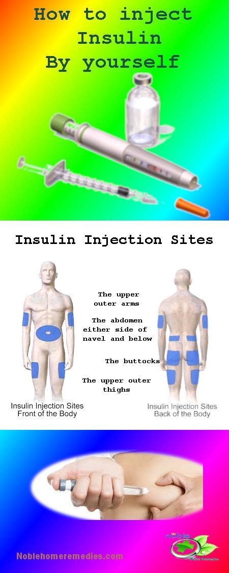 Insulin Injection Sites - Learn how to Inject - Type1 & Type2 Diabetes ...