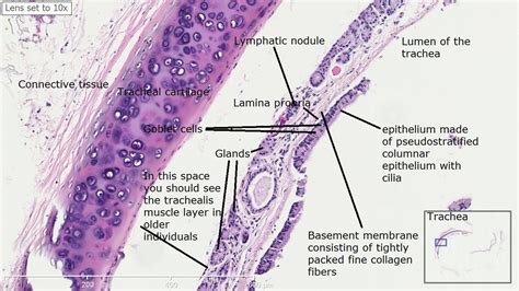 Trachea and Esophagus Histology | TracheaHistology,_点力图库 | Histología