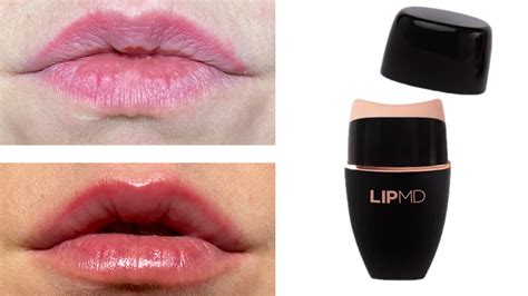 LipMD lip plumper gloss review: Before and after photos - mamabella