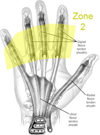 Digital Flexor Tendon Sheath