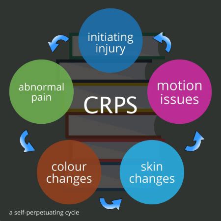 Complex regional pain syndrome | KNEEguru