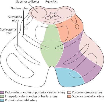 Basilar Artery Anatomy - Anatomy Book