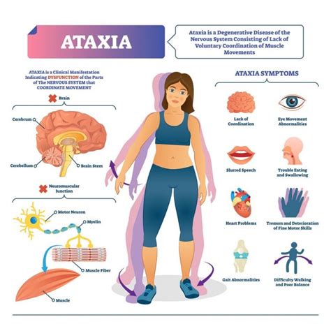 Cerebellar Ataxia and Exercise – Vision Health