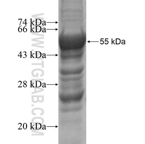 CD40L; CD154 Fusion Protein Ag10147 | Proteintech