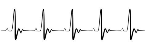 ECG Heartbeat Line. Electrocardiogram vector illustration. Normal Sinus ...