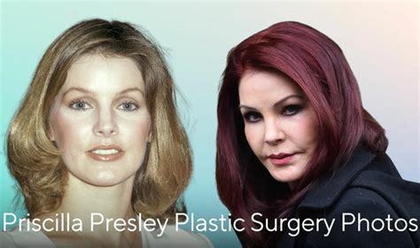 Priscilla Presley Plastic Surgery Photos Over The Years