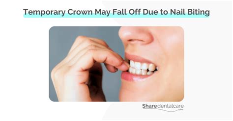 Temporary Crown Fell off Root Canal: How to Fix it? - Share Dental Care