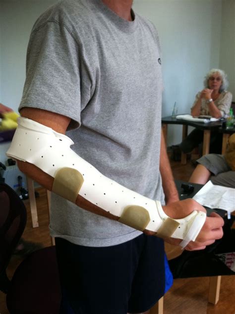 Munster splint, prevents forearm rotation; often used for protection of ...