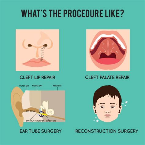 Cleft Lip & Palate - Beverly Wilshire Medical