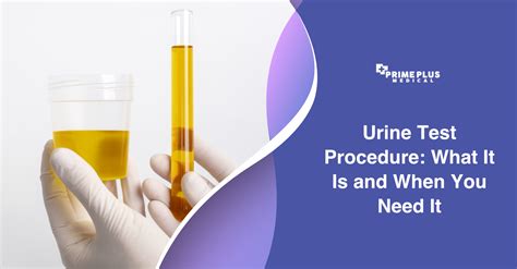 Urine Test Procedure: When You Need It - Prime Plus Medical