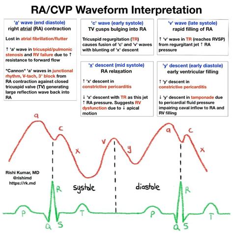 cvp waveform - Google Search in 2020 | Central venous pressure ...