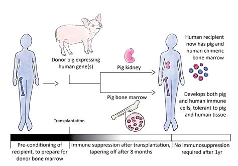 Xenotransplantation: Can pigs save human lives? - Science in the News