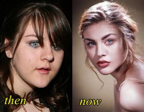 Frances Bean Cobain Plastic Surgery Before and After