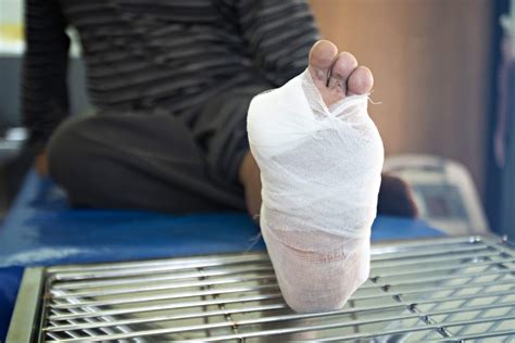 How Diabetic Foot Ulcers Lead to Amputations - Podimetrics