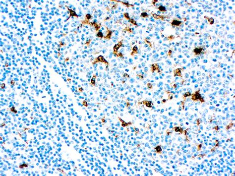 Lysozyme Antibody – Diagnostic BioSystems (DBS)