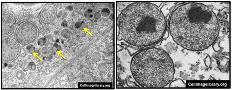 Lysosomes Under Electron Microscope