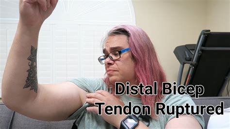 My Distal Bicep Tendon Rupture and Repair - Day Before Surgery - YouTube