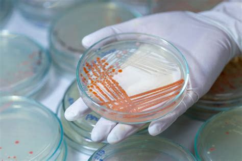 Serratia Marcescens Stock Photos, Pictures & Royalty-Free Images - iStock