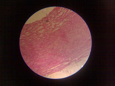 Medical Images Gallery: Histology of Aorta Slide With Summary