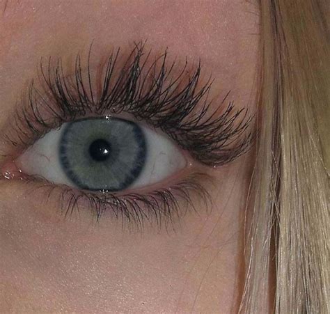 I Have A Condition Caused Distichiasis That Causes My Eyelashes To Grow ...