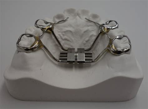 Orthodontic appliance made in China orthodontic lab, if you are interesting, please visit: www ...