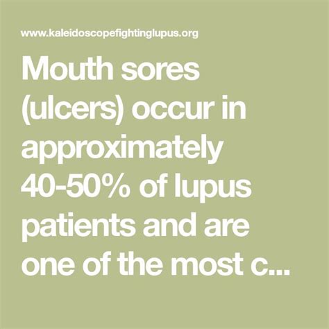 Mouth sores (ulcers) occur in approximately 40-50% of lupus patients ...