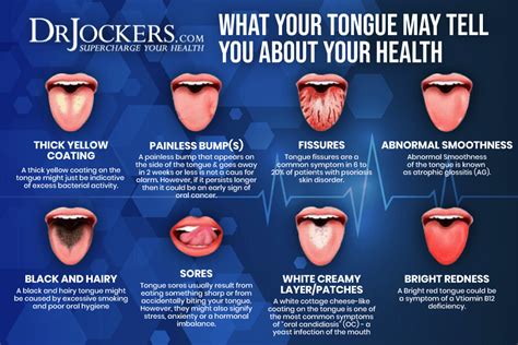 Tongue Mapping To Discover Hidden Health Problems