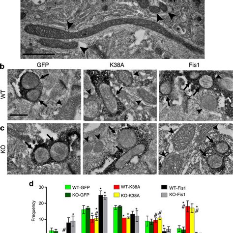 Tyrosine hydroxylase immunohistochemistry in the control group ...