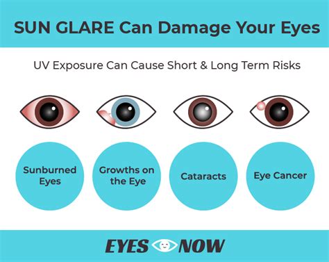 Can Sun Glare Damage Your Eyes? | Eyes Now