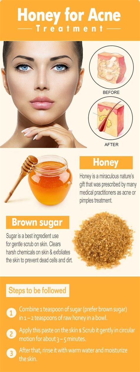 Honey-ACNE | Acne remedies homemade, Honey for acne, Acne cure