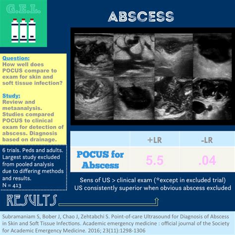 emDOCs.net – Emergency Medicine EducationUltrasound G.E.L. – Ultrasound ...