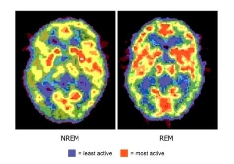 CuriouSTEM - The Brain Activity when you Sleep