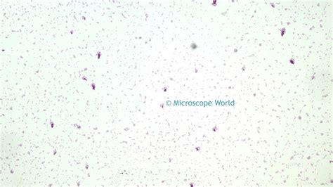 Microscope World Blog: Salmonella under the Microscope