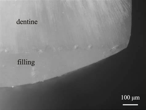 Images of tooth root cross-section: a) appearance; b) a control area;... | Download Scientific ...