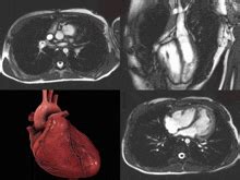 Heart Anatomy GIF - Heart Anatomy - Discover & Share GIFs