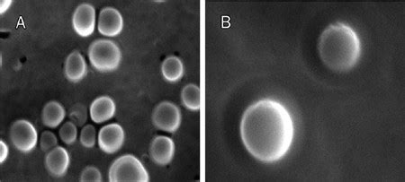 Drug packaging and delivery using perfluorocarbon nanoparticles for targeted inhibition of ...