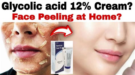 Glyco - 12% Cream Review? | Glycolic Acid Skin Peeling at home? | Uses ...