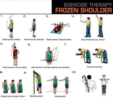 15 best Frozen Shoulder Exercises images on Pinterest | Frozen shoulder exercises, Frozen ...