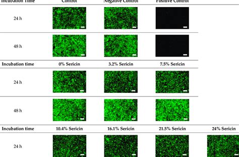 Fluorescence images of the cell viability assay of the silk nonwoven... | Download Scientific ...